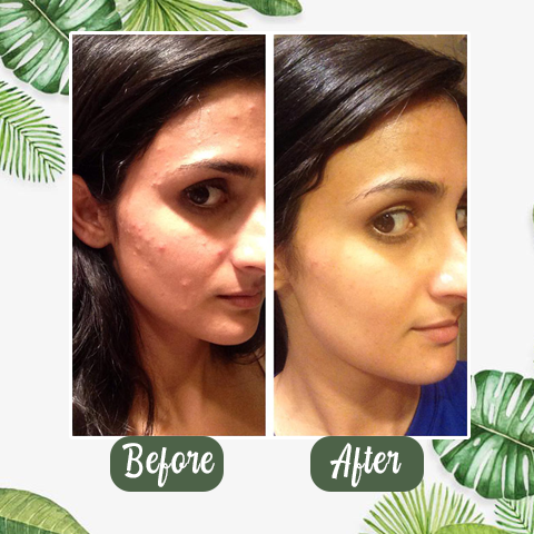 Buy 1 Get 1 Free - Green Tea Deep Cleanse Mask