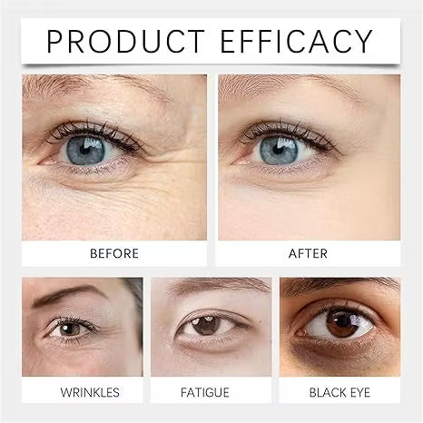 Limited Time 49% OFF 🔥 –✨Eye Serum Oil  Reveal Timeless Radiance